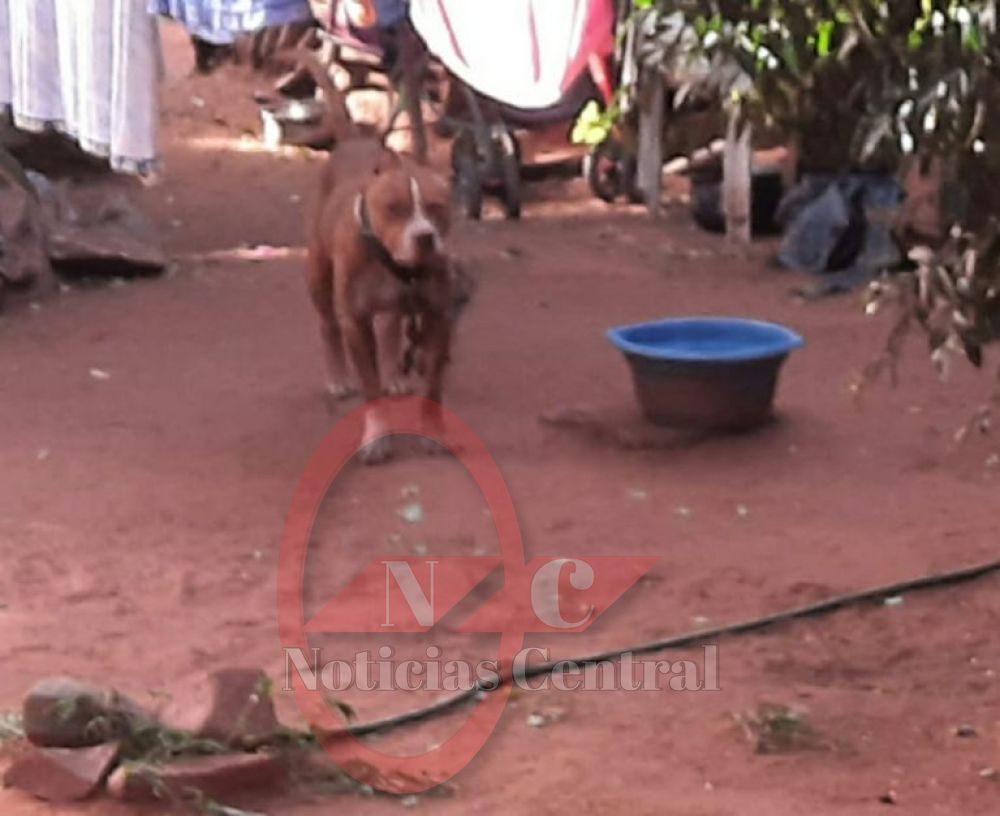 Muere un bebé de 11 meses tras brutal ataque de un pitbull en Ñemby