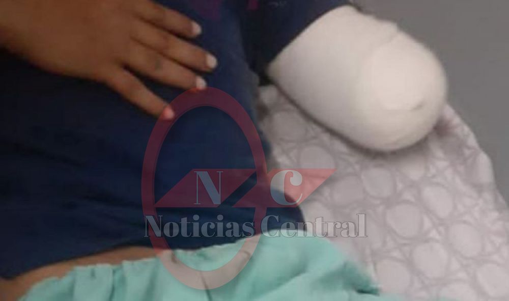 Gua’i alcoholizado y con antecedentes por robo perdió un antebrazo y no se acuerda como ni donde