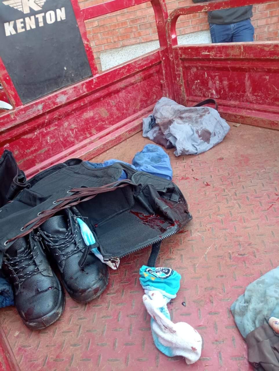 Guardia de seguridad fue golpeado y herido con arma blanca por delincuentes