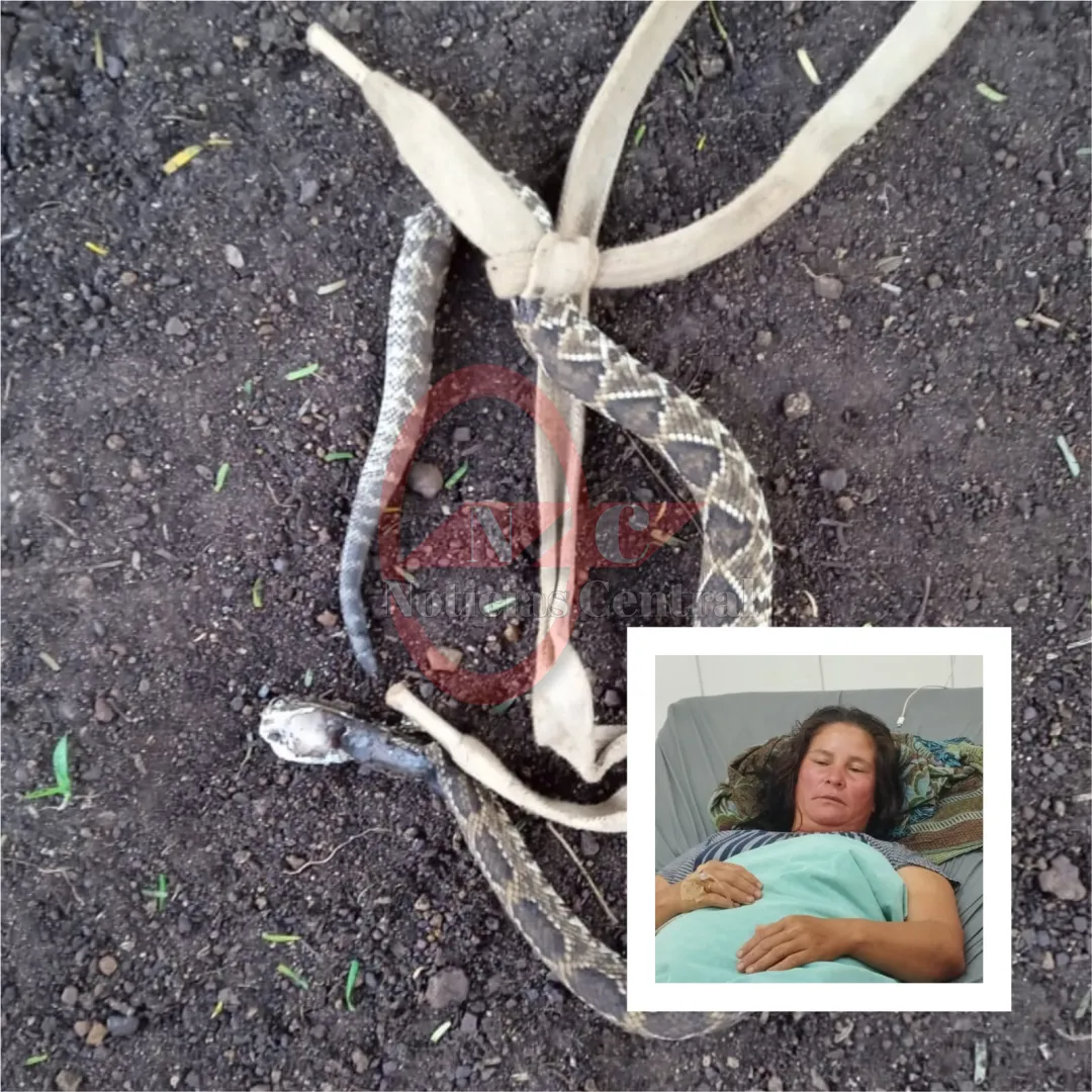 Mujer fue mordida por una serpiente en el patio de su casa en Pedro Juan Caballero