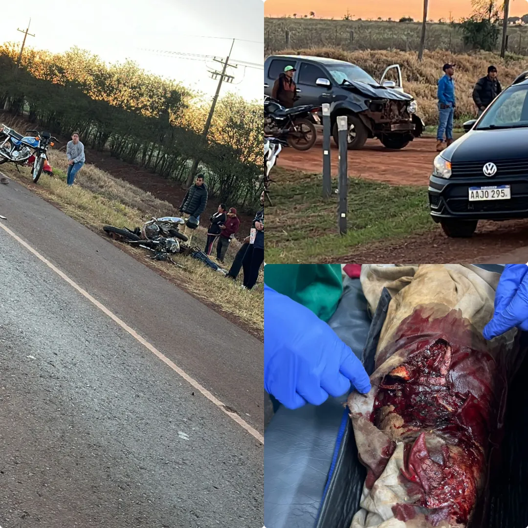 Grave accidente en Cerro Corá deja dos motociclistas heridos