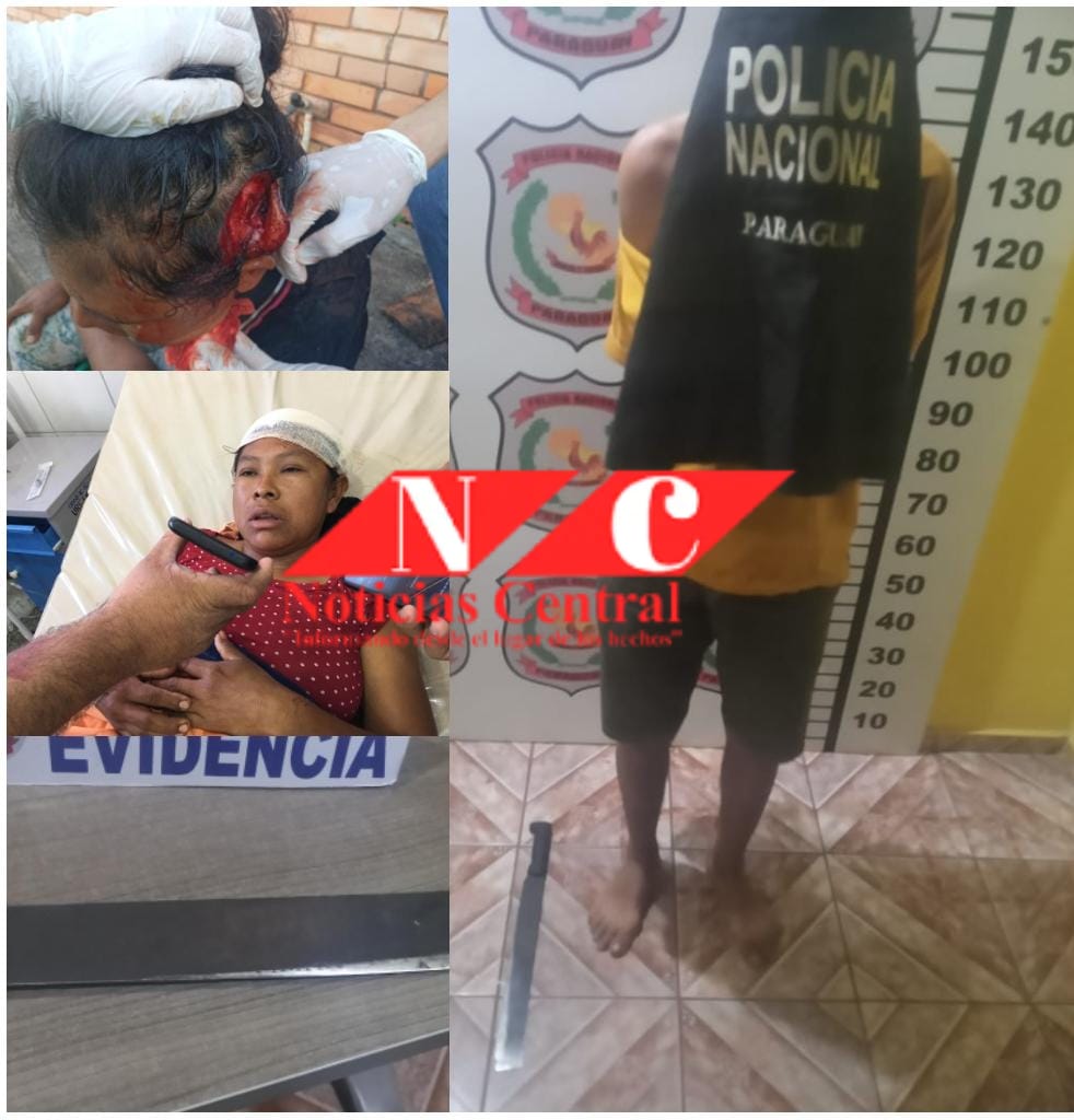 Hombre detenido por "machetear" a su hijastra y cuñada en la cabeza