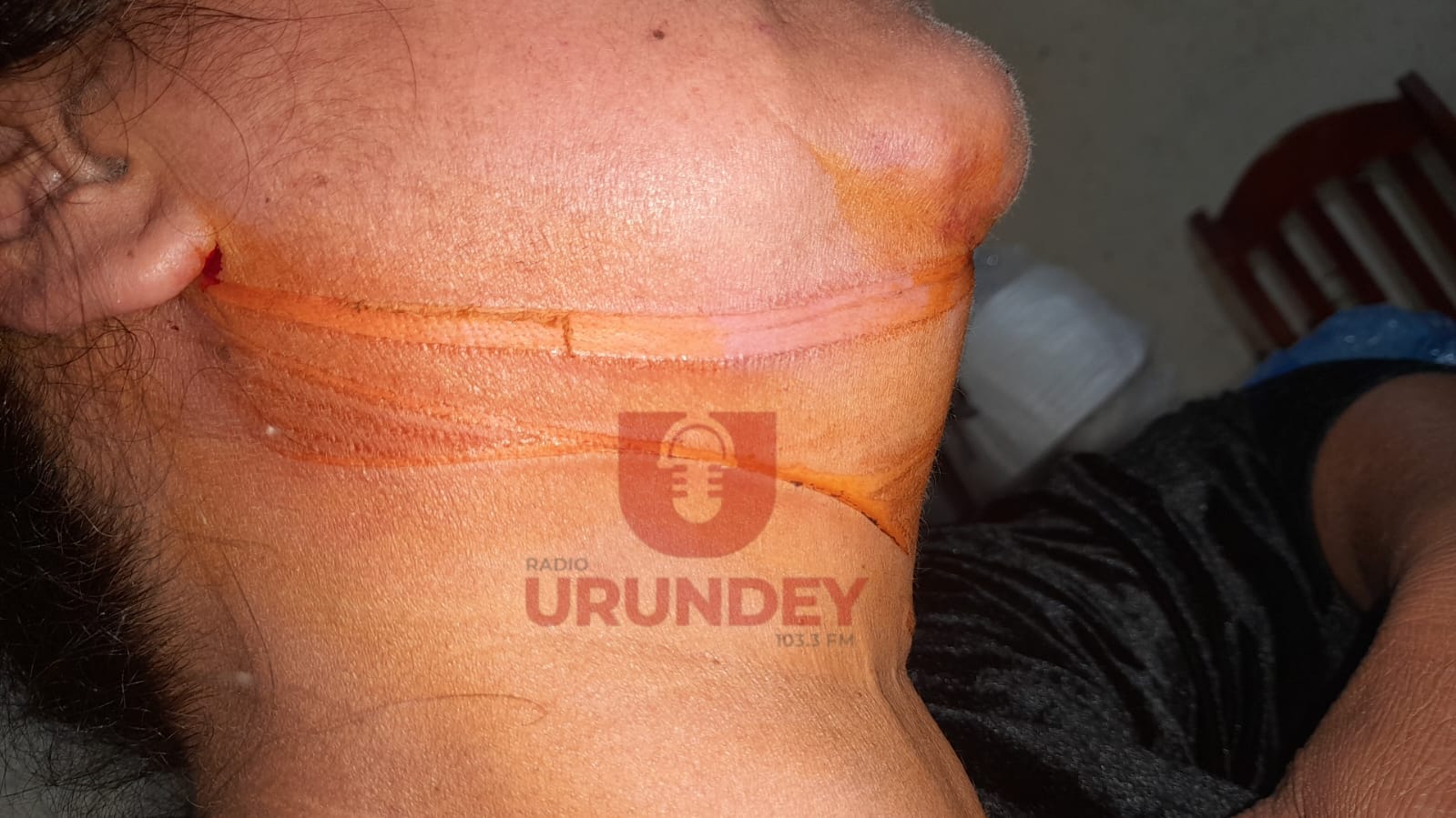 Hilo de pandorga se lió por el cuello de una motociclista