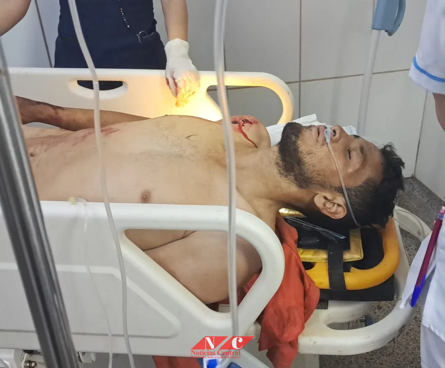 Joven gravemente herido en la colonia Potrero Sur