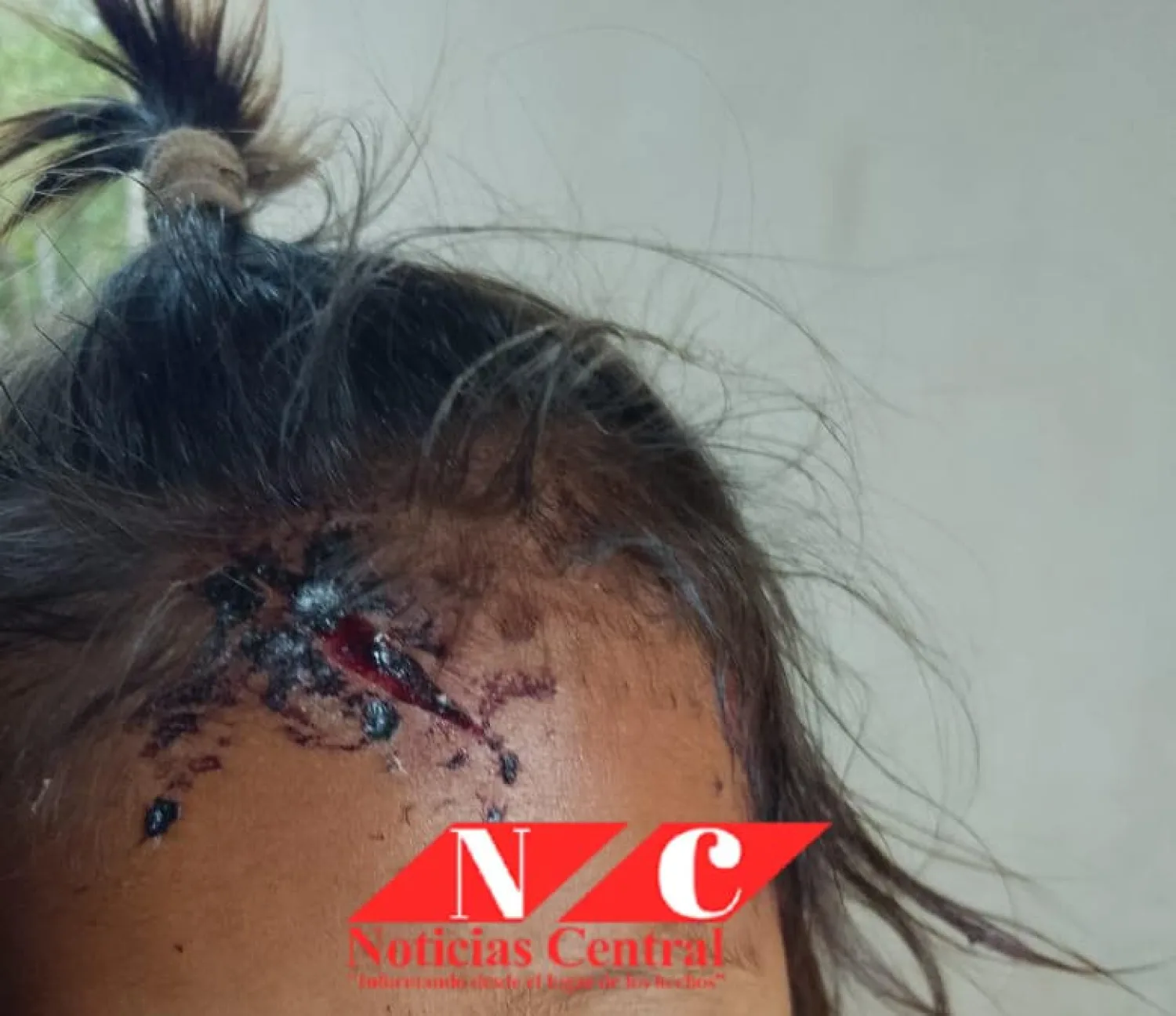 Aprehenden a joven por presunta agresión a su hija de un año en Cerro Corá