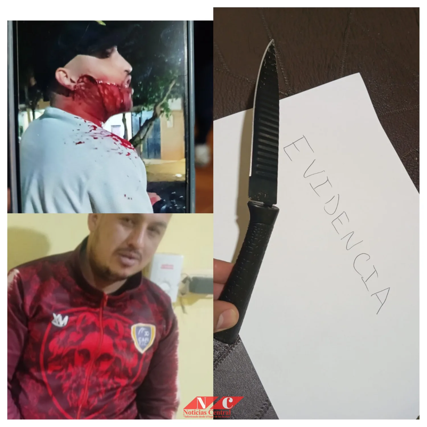 Hombre fue aprehendido tras herir con un cuchillo a su propio hermano