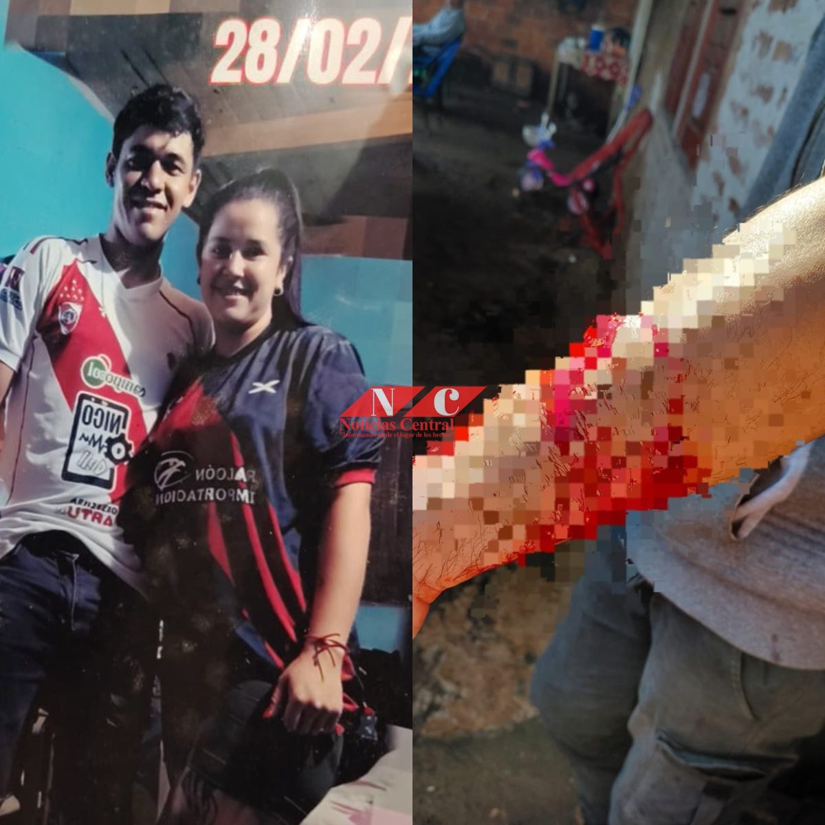 Mujer acuchilló a su pareja por celos tras querer salir a jugar fútbol Coronel Bogado