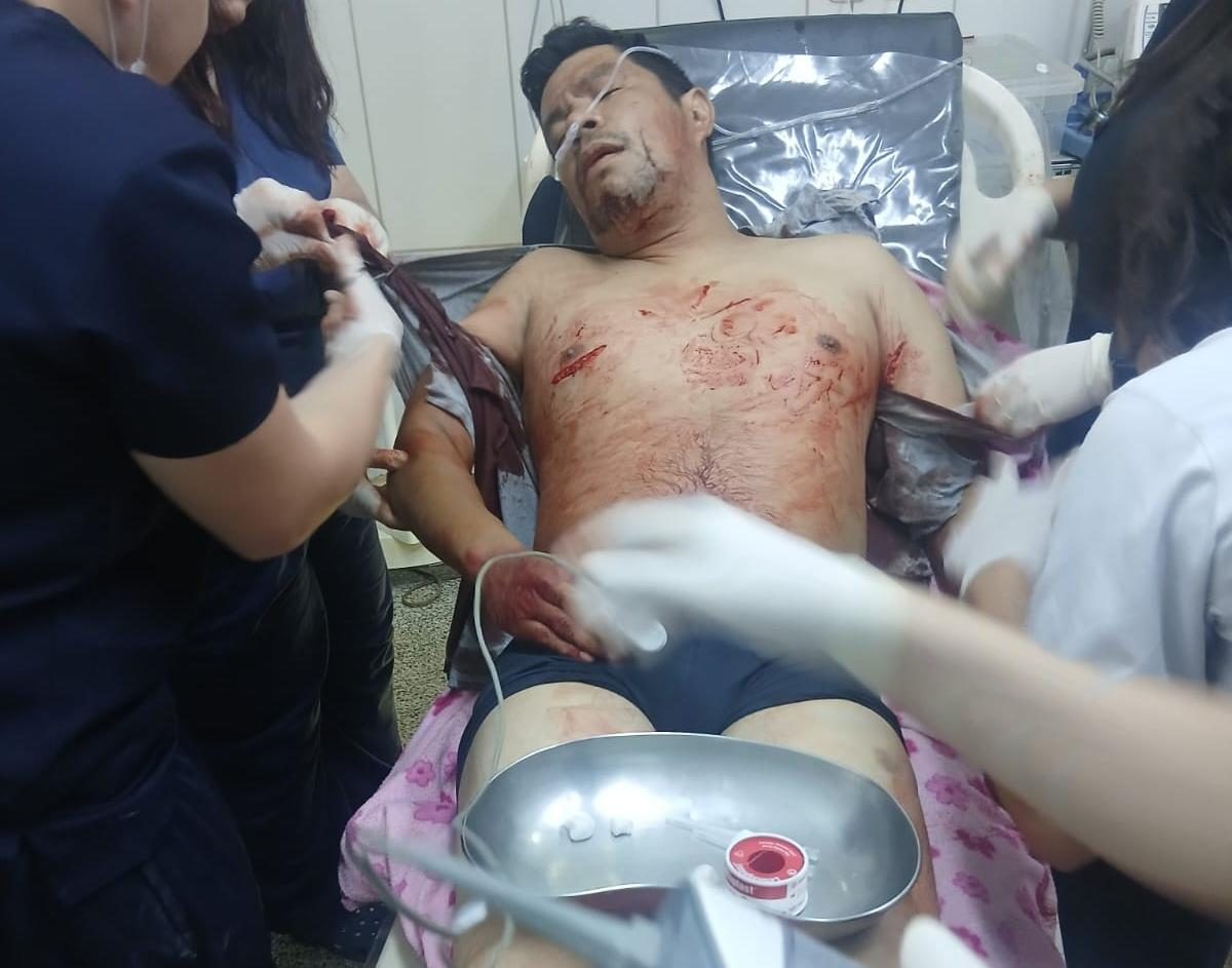 Hombre atacó a puñaladas al acompañante de su expareja en Pedro Juan Caballero