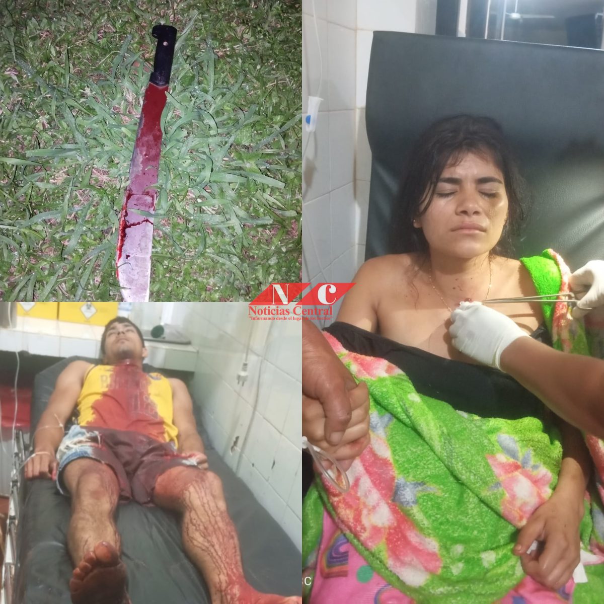 Investigan presunto intento de feminicidio en una zona rural de Loreto
