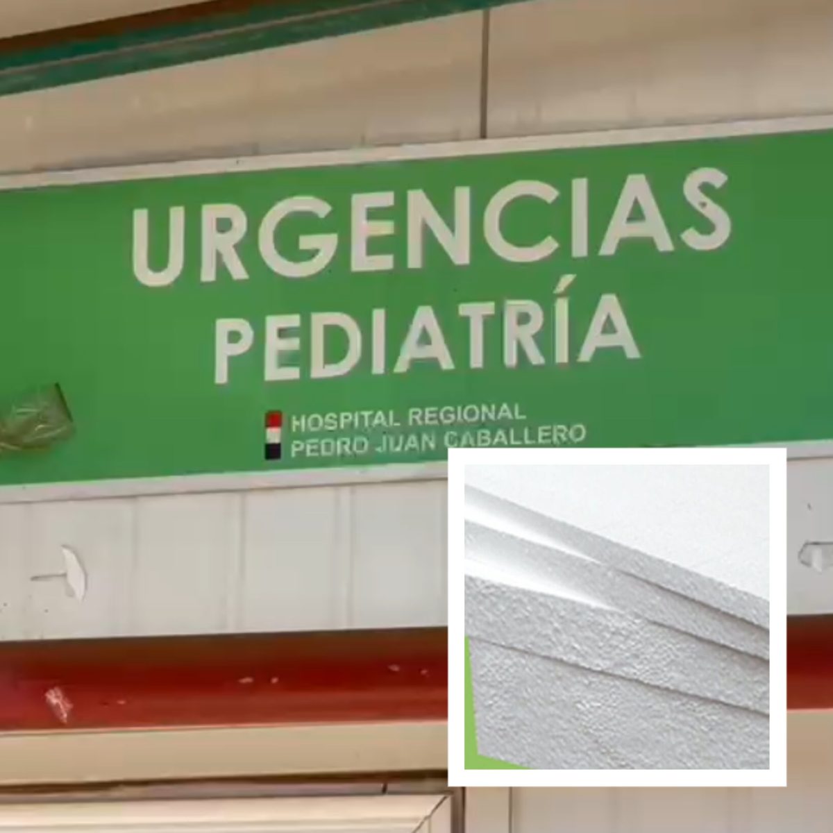 Pedro Juan Caballero: niña de 1 año y 9 meses sufrió asfixia tras tragar isopor y fue salvada por médicos